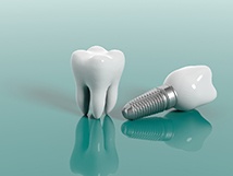 Model dental implant next to model tooth