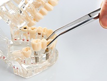Implant dentist placing restoration on model jaw